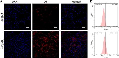 Laser-activated nanoparticles for ultrasound/photoacoustic imaging-guided prostate cancer treatment